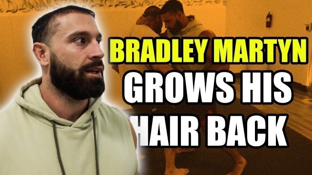 'BRADLEY MARTYN GROWS HIS HAIR BACK - Did The PRP Work!?'