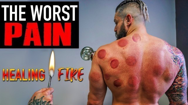 'The WORST PAIN - Can FIRE CUPPING / Hijama Fix Muscle Injury??  (Lex Fitness Before & After Results)'